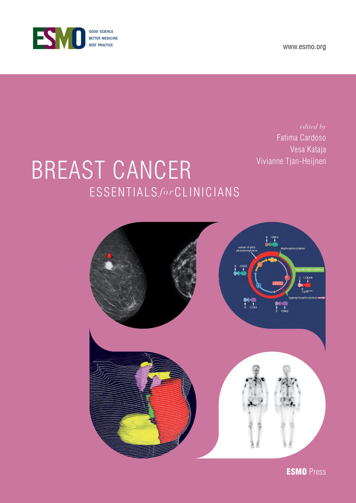 2017 ESMO Essentials for Clinicians Breast Cancer cover